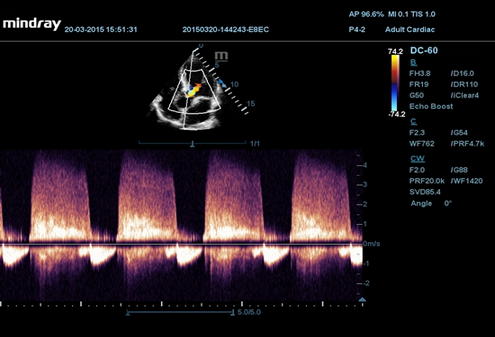 5C AR CW