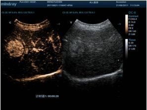 UWN Contrast Imaging™